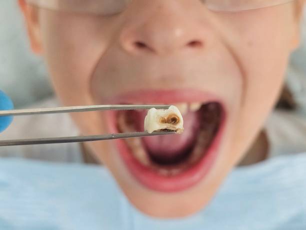 Best Emergency Treatment for Jaw Pain or Injury in Cranford, NJ